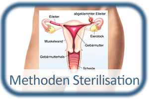 Methoden Sterilisation